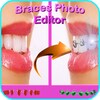 Braces Photo Editor 2017 icon