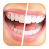 Wie Sie Ihre Zähne weiß icon