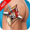 Biểu tượng Hip Surgery