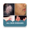 Ikon Skin diseases and treatment of