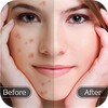 Face Blemish Remover icon