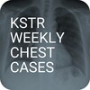 KSTR Weekly Chest Cases icon