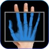 Ikon X-Ray Photo Camera Fillter