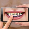 Braces photo editor icon