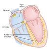 Cardiac Arrhythmia & Treatment icon