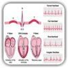 ECG / EKG Rhythm Step-by-Step Interpretation icon