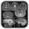 Imaging Brain, Skull & Craniocervical Vasculature icon