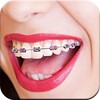 Braces Camera icon