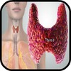 Thyroid Symptoms Treatment icon