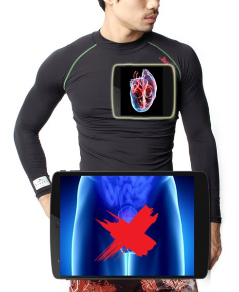 Xray Photo - Preview 1