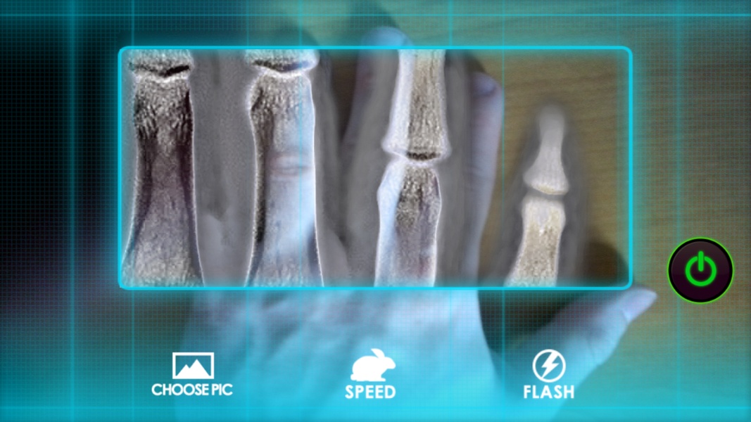 X-Ray Scanner: Augmented Prank - Preview 1