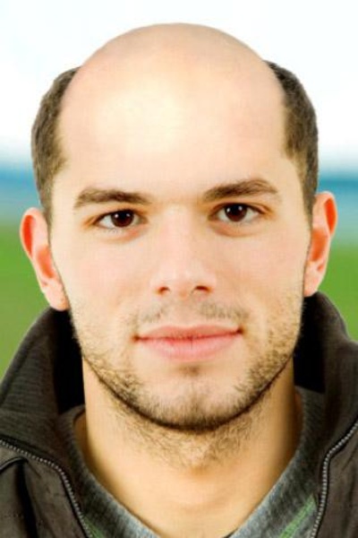 BaldBooth - Preview 3