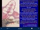 Neuroanatomy - SecondLook screenshot 3