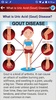 Tips & Diet for Arthritis Gout and Uric Acid screenshot 15