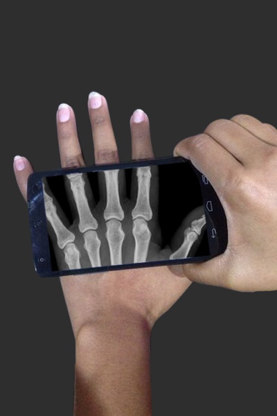 X_Ray Scanner - Preview 9