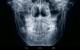 Xray Prank screenshot 3