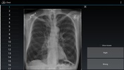 Radiology Flashcards: Free screenshot 2