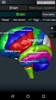Brain and Nervous System 3D screenshot 7
