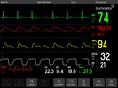 TruMonitor - TruVent - Simulat screenshot 4