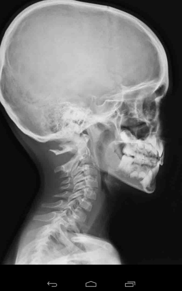 X-ray Cam Prank - Preview 3
