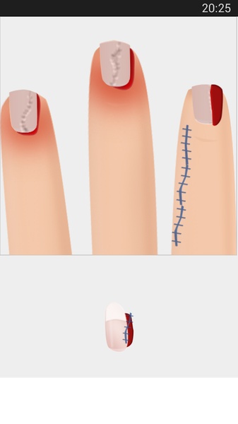 Nail Surgery - Preview 1