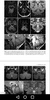 Imaging Brain, Skull & Craniocervical Vasculature screenshot 4