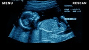X-Ray Scanner Pregnant Joke screenshot 2