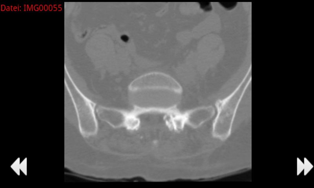 Minimal Dicom Viewer - Preview 1