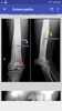 Musculoskeletal X- Rays Interpretation screenshot 5