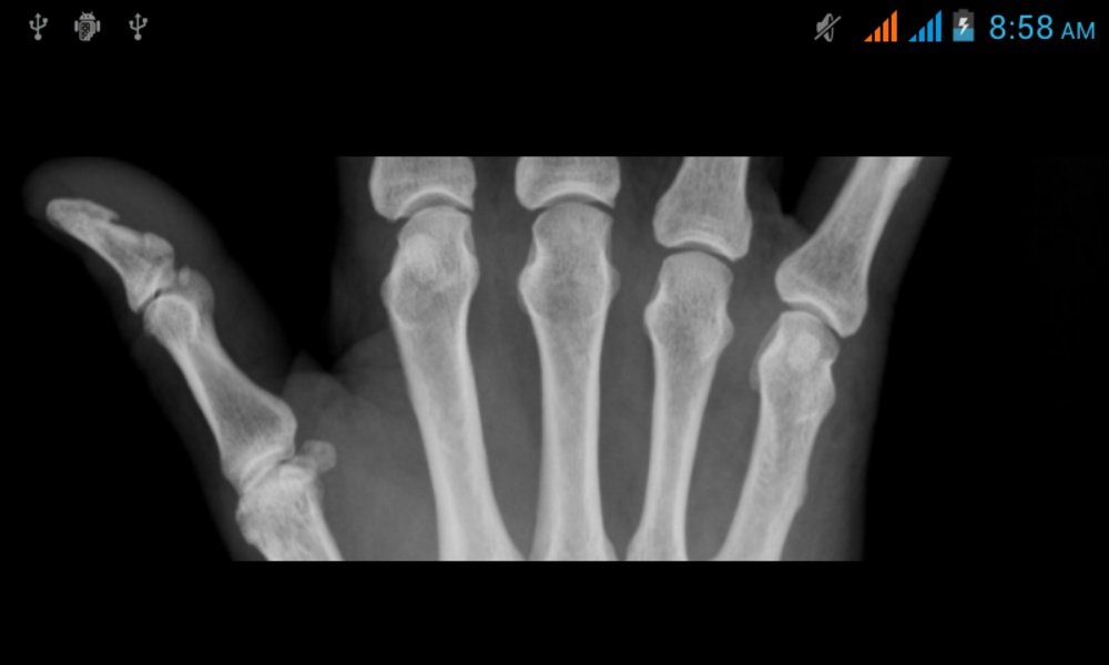 XRay - Preview 4