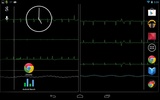 Bedside ECG Monitor screenshot 1