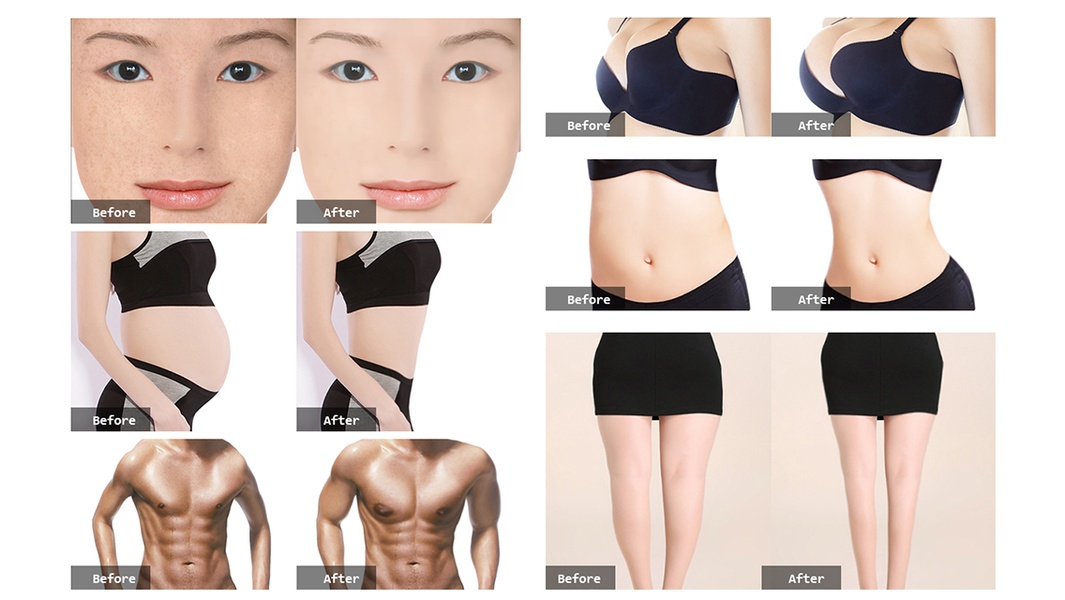 PhotoPlasticSurgeryProfessional - Preview 1