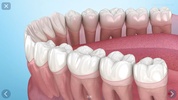 Dental 3D Illustrations screenshot 7