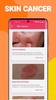 Skin Diseases and Treatments screenshot 4