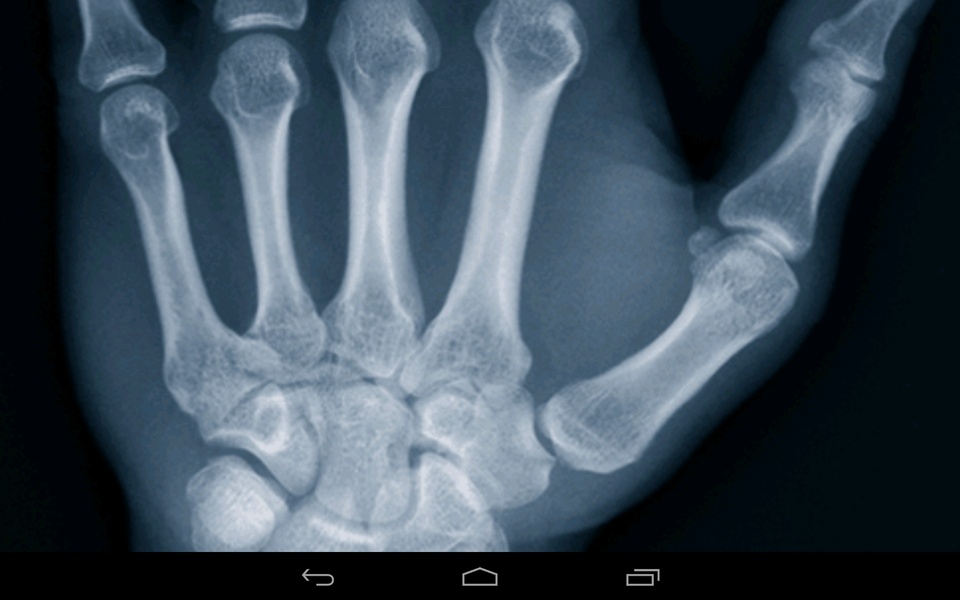 Xray Prank - Preview 4