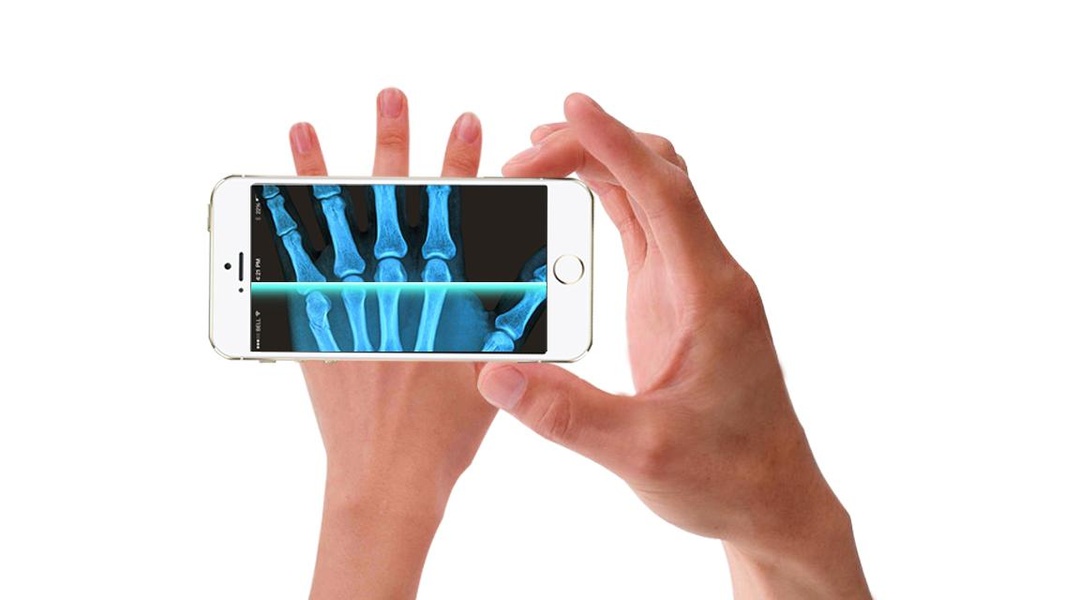 Xray Scan 2 - Preview 10