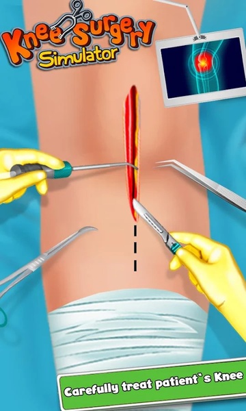 KneeSurgery - Preview 2