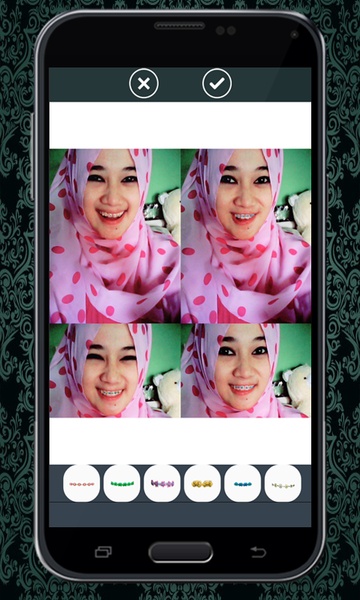 Brace Camera Beauty - Preview 1