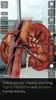 Insight Kidney screenshot 15