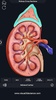 Urinary System screenshot 15