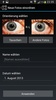 Eye Diagnosis screenshot 7