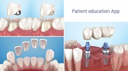 Dental 3D Illustrations screenshot 10