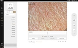 2.0 Artistry Skin Analyzer screenshot 8