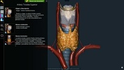 3D Anatomy Learning screenshot 3