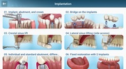 Dental 3D Illustrations screenshot 13