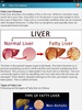 Fatty Liver Diet Healthy Foods screenshot 7