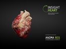 Insight Heart screenshot 2