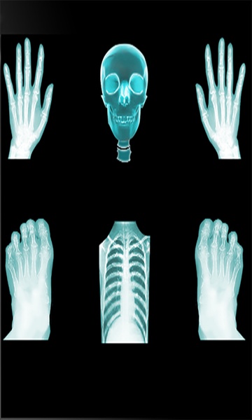 X-RayScanner - Preview 1