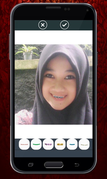 Brace Camera Beauty - Preview 3