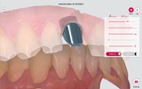 3Shape Communicate screenshot 4